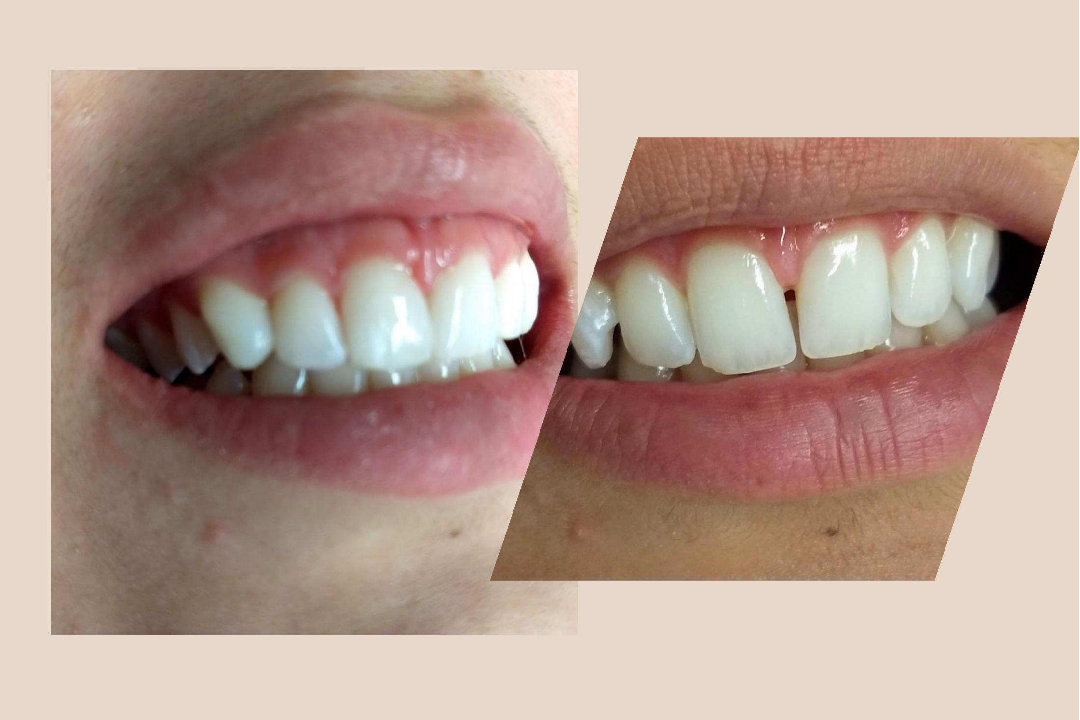 Ziade Odontologia - Estética -01
