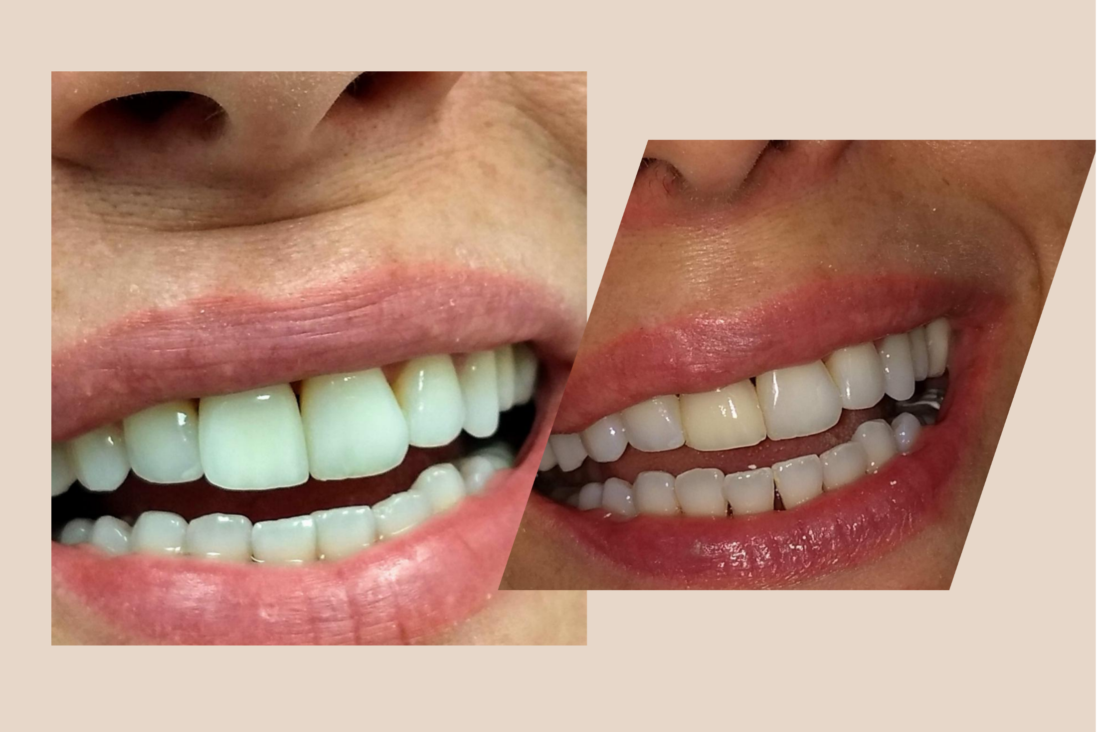 Ziade Odontologia - Estética - 02
