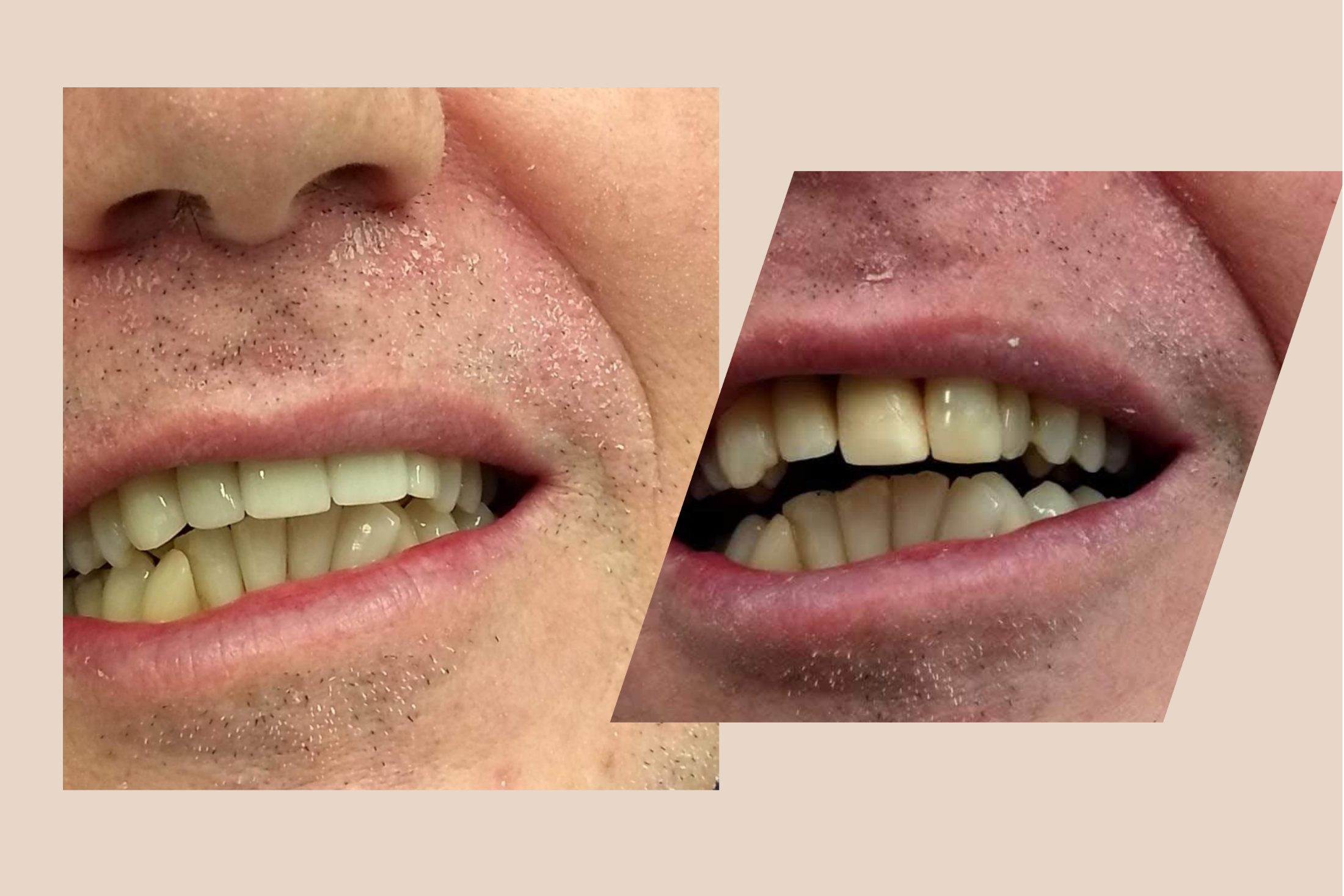 Ziade Odontologia - Estética - 03