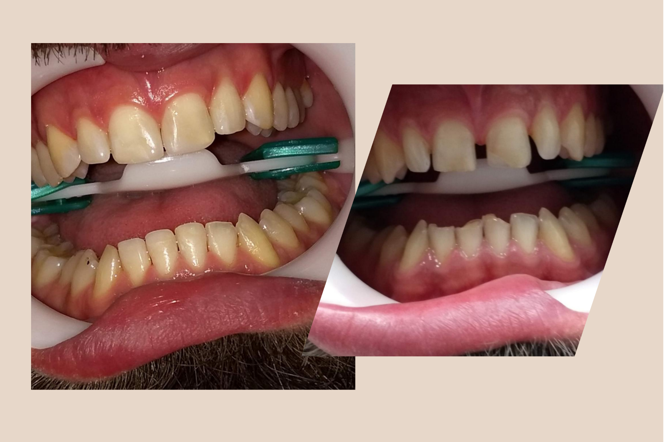 Ziade Odontologia - Estética - 04